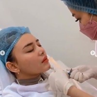 Menurut keterangan di video tersebut, Amanda Manopo sedang treatment punyuntikan vitamin E pada pipi dan dagu. Tujuannya agar bibir terlihat lebih tirus. (Foto: Instagram/@nurmala_suryani15)
