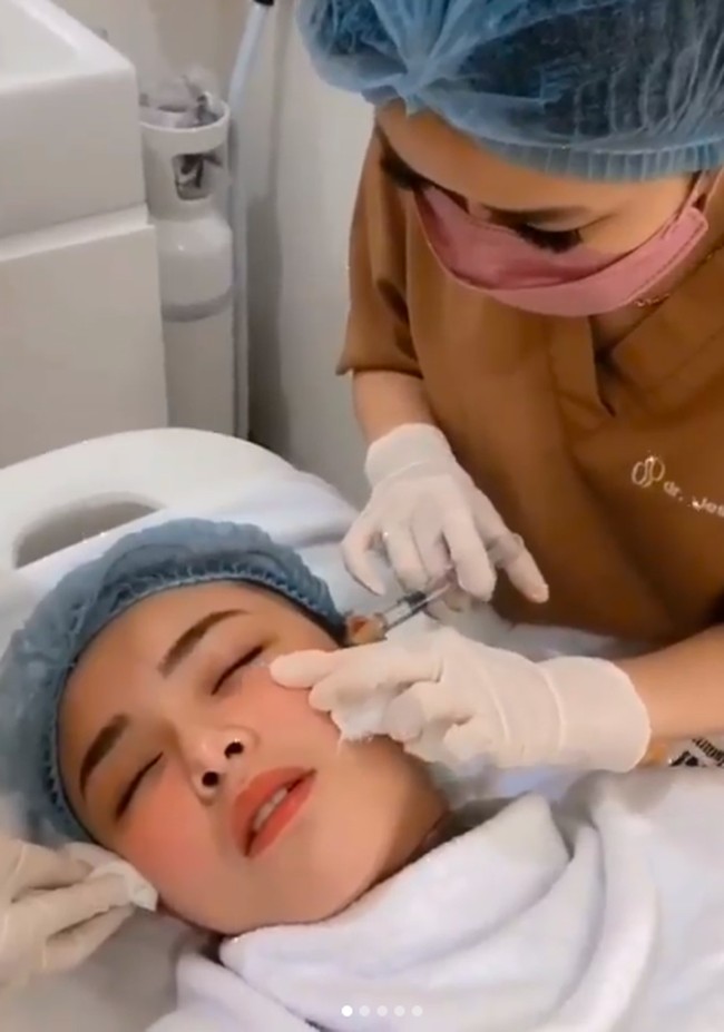 Sebelumnya, Amanda Manopo disebut-sebut melakukan operasi plastik sampai-sampai menuai hujatan netizen. Sang kakak, Angelica Manopo, pun buka suara. Ia menegaskan adiknya itu tak melakukan operasi. Amanda hanya menyuntikkan vitamin C pada bibirnya itu. (Foto: Instagram/@nurmala_suryani15)