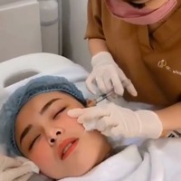 Sebelumnya, Amanda Manopo disebut-sebut melakukan operasi plastik sampai-sampai menuai hujatan netizen. Sang kakak, Angelica Manopo, pun buka suara. Ia menegaskan adiknya itu tak melakukan operasi. Amanda hanya menyuntikkan vitamin C pada bibirnya itu. (Foto: Instagram/@nurmala_suryani15)