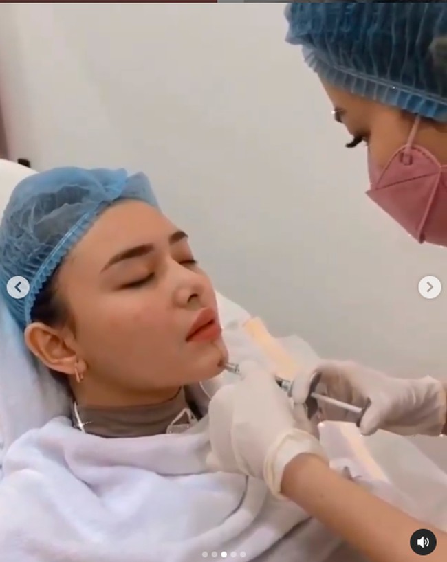 Inilah detik-detik ketika dagu Amanda Manopo disuntik seperti yang terlihat di sebuah video unggahan Instagram fansnya. (Foto: Instagram/@nurmala_suryani15)