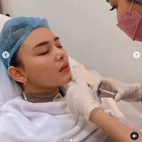 Inilah detik-detik ketika dagu Amanda Manopo disuntik seperti yang terlihat di sebuah video unggahan Instagram fansnya. (Foto: Instagram/@nurmala_suryani15)
