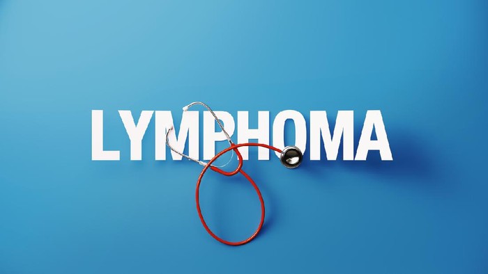 Dokter Sebut Limfoma Hodgkin Punya Tingkat Kesembuhan Tinggi