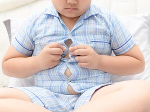 Fakta Tentang Obesitas, Ini Kata Pakar Penyakit Dalam Unair