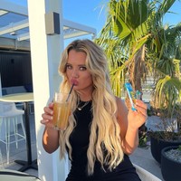 Tolong jangan mencoba prosedur kecantikan DIY di rumah, Tilly memperingatkan di Instagaramnya. Foto: Instagram