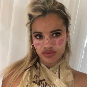 Ikuti DIY Kecantikan dari TikTok, Influencer Ini Berakhir Masuk Rumah Sakit Ikuti DIY Kecantikan dari TikTok, Influencer Ini Berakhir Masuk Rumah Sakit