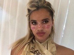 Foto: Wajah Influencer Penuh Bekas Luka, Ikuti Trik Kecantikan di TikTok