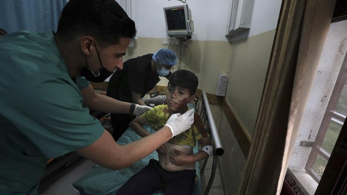 Palestinians Israel A wounded boy lies on a stretcher in a hospital following an explosion in the town of Beit Lahiya, northern Gaza Strip, on Monday, May 10, 2021, during a conflict between Hamas and Israel. (AP Photo/Mohammed Ali)