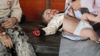 Pilu! Bagaimana seorang bayi jadi korban di negara perang. Foto: Instagram/ugurgallen