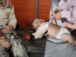 Simpati Palestina, Ini Potret Kontras Negara Konflik dan Damai