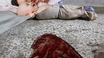 Foto-fotonya sungguh menyayat hati (Foto: Instagram/ugurgallen)