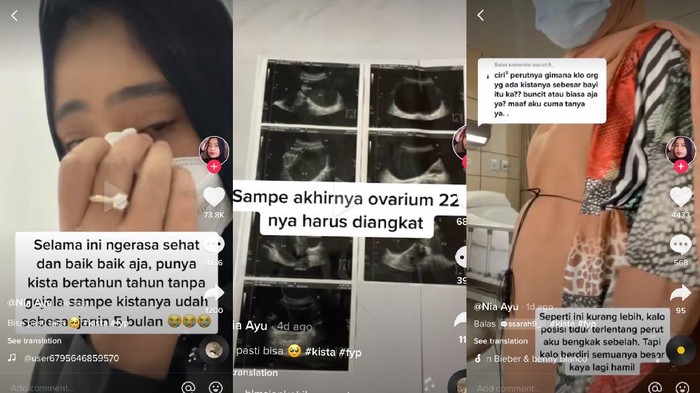 Viral Idap Kista Bak Hamil 6 Bulan, Kedua Ovariumnya Harus Diangkat Viral Idap Kista Bak Hamil 6 Bulan, Kedua Ovariumnya Harus Diangkat