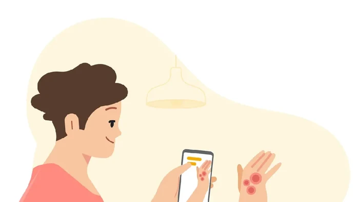 Alat Kecerdasn Buatan Google Identifikasi Kulit