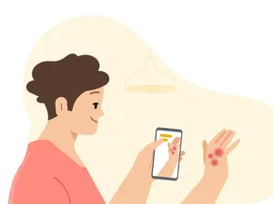 Alat Kesehatan Google Bisa Identifikasi Kondisi Kulit