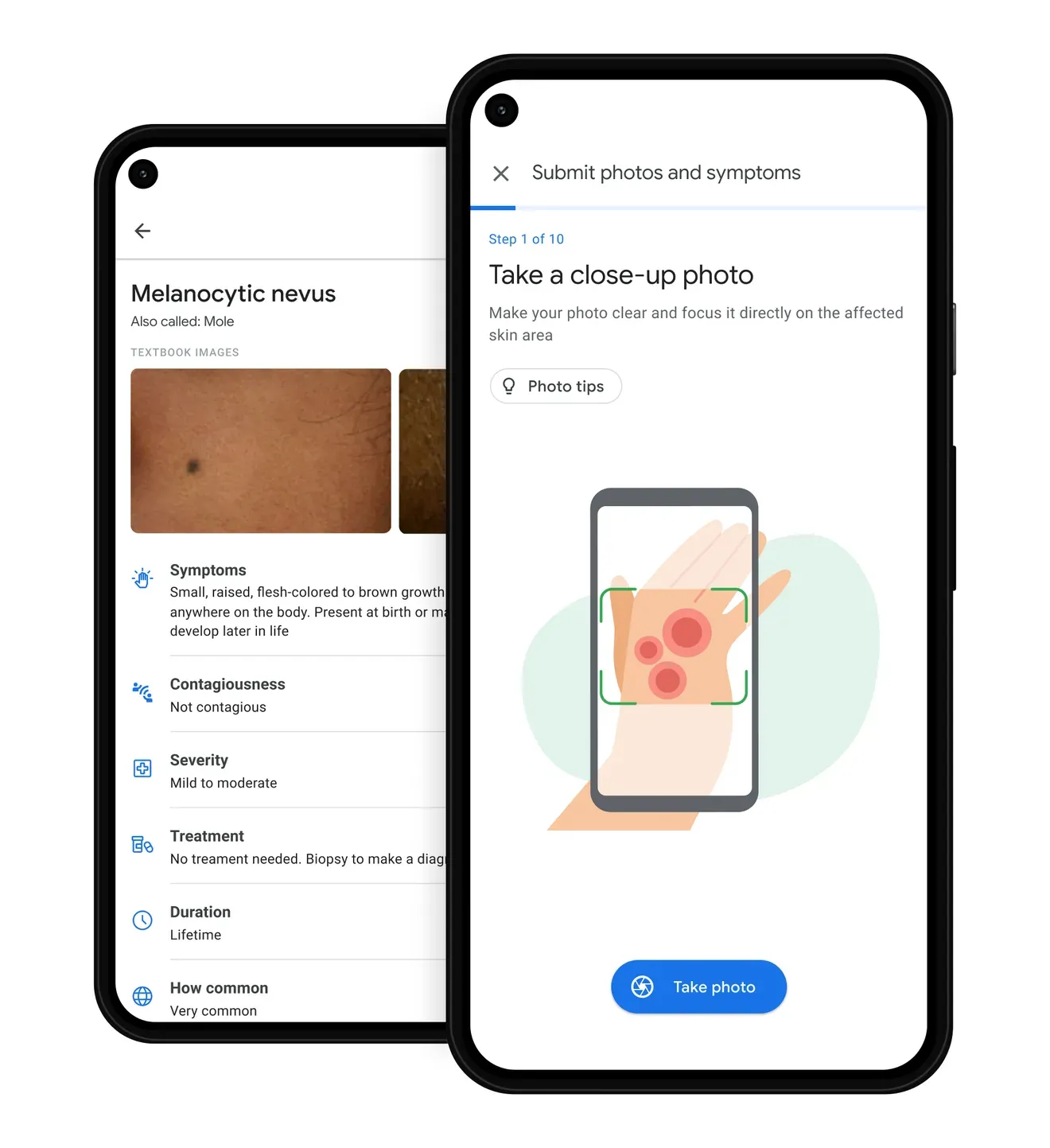 Alat Kecerdasn Buatan Google Identifikasi Kulit