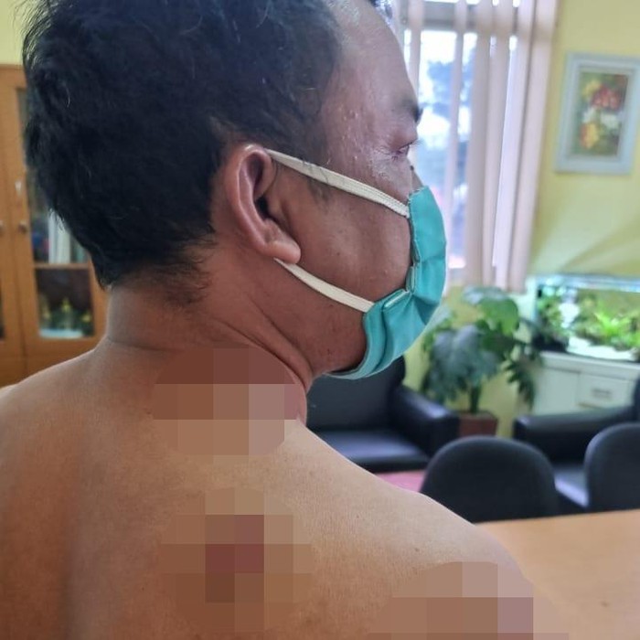 Sopir Taksi Online Ditembak Begal di Lebak