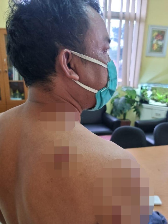 Sopir Taksi Online Ditembak Begal di Lebak