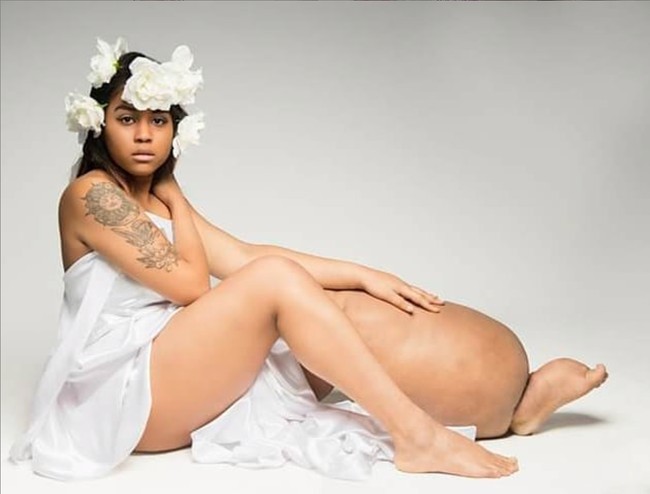 Walaupun penyakitnya tak bisa disembuhkan, tetapi ada beberapa cara yang bisa dilakukan Mahogany untuk meminimalkan pembengkakan pada kakinya, yaitu dengan rutin melakukan fisioterapi dan pijat drainase limfatik. Foto: Instagram/@lymph.goddess23