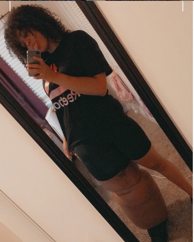 Dari 133 kg berat tubuhnya, 44 kg diantaranya adalah berat dari kaki Mahogany yang bengkak. Karena kondisinya itu, Mahogany juga mengaku kerap mendapatkan ejekan. Foto: Instagram/@lymph.goddess23