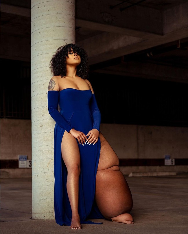 Dengan kondisinya itu, Mahogany mengaku sering mendapat ejekan dan disarankan untuk melakukan amputasi agar penampilannya lebih baik. Namun dirinya tidak terlalu mempedulikan komentar-komentar negatif yang diterimanya. Foto: Instagram/@lymph.goddess23