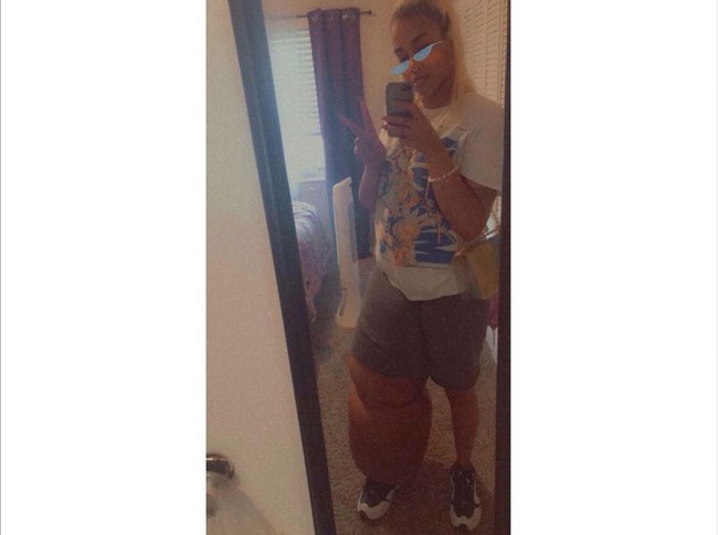 Saat ini Mahogany mengaku lebih percaya diri karena memperoleh banyak dukungan, seperti dari ibu dan komunitas online Lymphedema. Hal itu membuatnya lebih menyadari seberapa cantik dirinya. Foto: Instagram/@lymph.goddess23