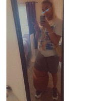 Saat ini Mahogany mengaku lebih percaya diri karena memperoleh banyak dukungan, seperti dari ibu dan komunitas online Lymphedema. Hal itu membuatnya lebih menyadari seberapa cantik dirinya. Foto: Instagram/@lymph.goddess23