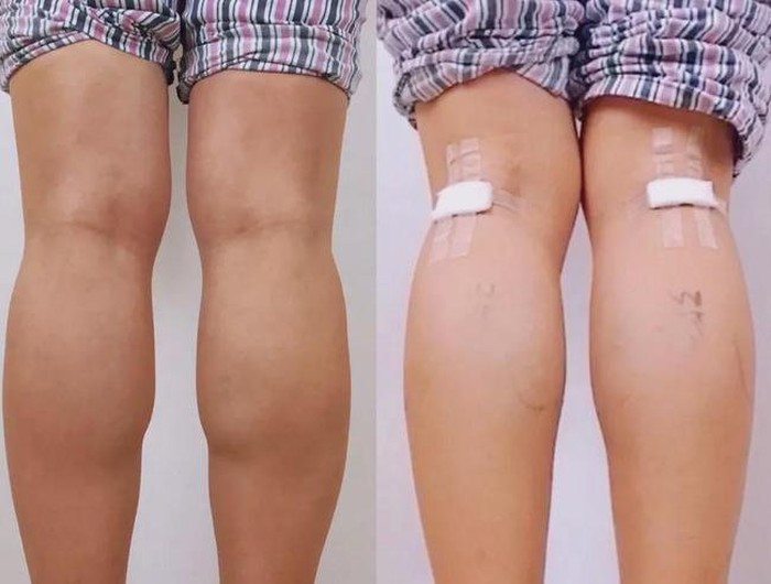 Tren kecantikan ekstrim yang viral di China