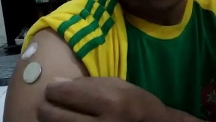 Tangkapan layar video viral koin menempel di bekas suntikan vaksin COVID-19 (Foto: Istimewa) Tangkapan layar video viral koin menempel di bekas suntikan vaksin COVID-19 (Foto: Istimewa)