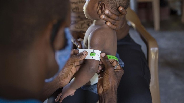 Jean Gough, UNICEF regional director for Latin America and the Caribbean, greets an infant in a malnutrition clinic in Les Cayes, Haiti, Wednesday, May 26, 2021. Gough visited the southern seaport amid concerns over an increase in malnutrition and a drop in childhood immunizations that officials blame on the coronavirus pandemic. (AP Photo/Joseph Odelyn)