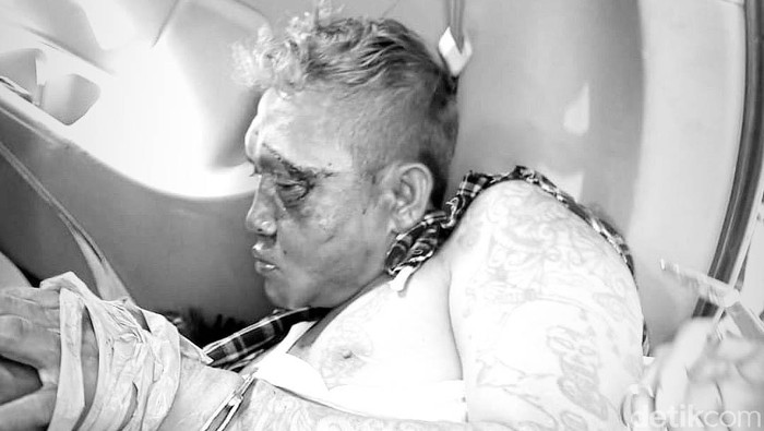Dadang 'Buaya' yang Serang Markas TNI-Polri di Garut Dibekuk Kelompok preman Dadang 'Buaya' Cs menyerang markas Koramil dan Polsek Pameungpeuk Garut. Dadang akhirnya ditangkap petugas gabungan.