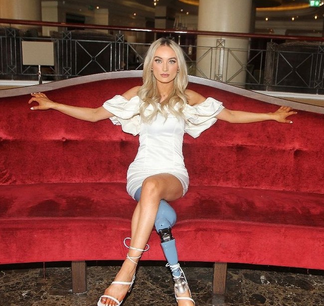 Jika aku lolos ke final Miss World, itu akan luar biasa dan menunjukkan kepada orang lain bahwa ada banyak kelebihan dari orang disabilitas, ucap Bernadetta.  Foto: dok. Instagram