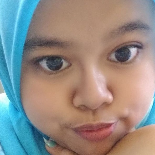 Seperti inilah penampakan hidung baru Kekeyi. Kekeyi mengaku semakin percaya diri dengan hidung yang lebih mancung.  Foto: dok. Instagram