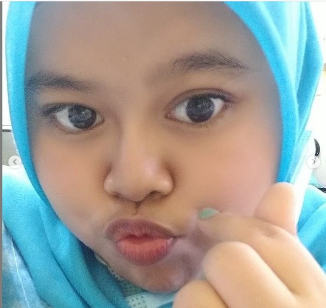 Beauty vlogger Kekeyi jadi sorotan karena penampilannya yang makin cantik. Kekeyi melakukan filler di bagian hidung.  Foto: dok. Instagram