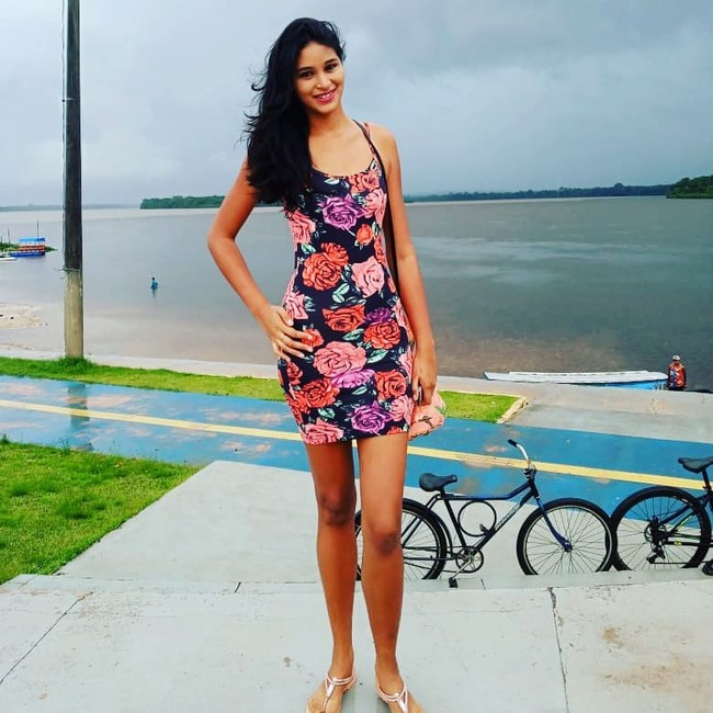 Saat itu keluarga mereka tidak mampu untuk membayar semua biaya tes. Tapi untungnya, sebuah stasiun televisi bersedia untuk menanggungnya untuk disiarkan dan terungkap bahwa penyebabnya adalah tumor jinak di kalenjar pituitari. Foto: Instagram @elisane_oficial