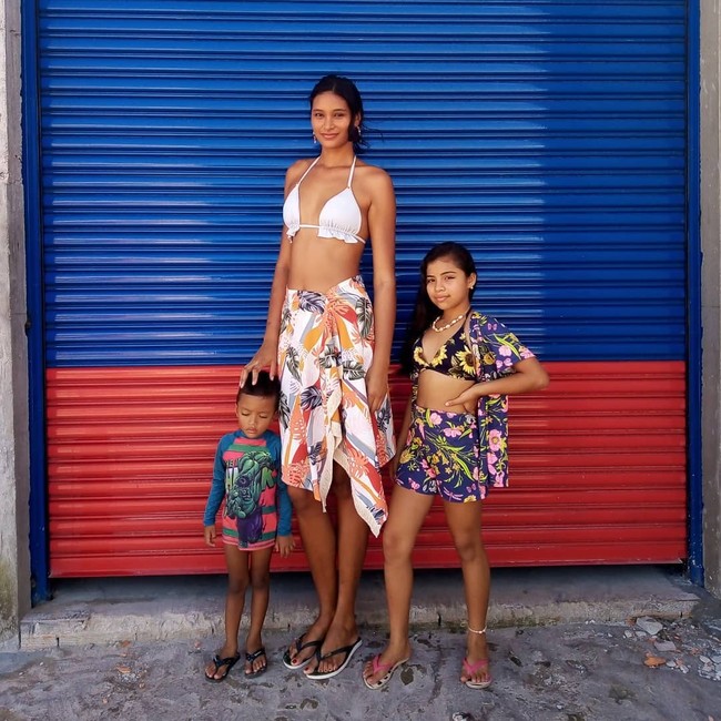 Sejak kecil, Elisa merasa berbeda dari kebanyakan orang karena selalu menjadi yang paling tinggi di antara keluarga dan lingkungan. Bukan karena olahraga atau keturunan dikatakan jika wanita 26 tahun itu bisa jadi sangat tinggi karena sebuah tumor. Foto: Instagram @elisane_oficial