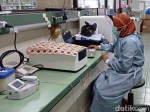 ITD Unair Ungkap Potensi Tanaman Ini Jadi Obat Anti-HIV, Jenis Apa Ya?