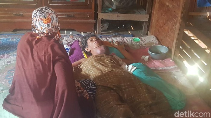 Warga Kabupaten Polewali Mandar, Sulbar, bernama Supri (57) hanya bisa terbaring di rumahnya. Janda 5 anak ini sudah lebih enam bulan mengidap tumor di leher. (Abdy/detikcom)