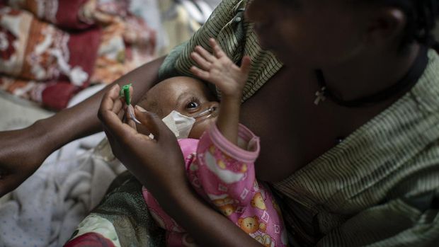 Birhan Etsana, 27, from Dengelat, uses a nasogastric tube to feed her malnourished baby, Mebrhit, who at 17 months old weighs just 5.2 kilograms (11 pounds and 7 ounces), at the Ayder Referral Hospital in Mekele, in the Tigray region of northern Ethiopia, on Monday, May 10, 2021. The lone survivor of her triplets, the infant was admitted with complications stemming from severe acute malnutrition, including heart failure. (AP Photo/Ben Curtis)