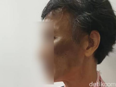 PMI asal Lampung menjadi korban penganiayaan majikan di Malaysia (dok KBRI Kuala Lumpur)