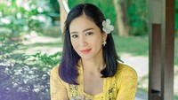 Bunga Zainal kini tengah dirawat di rumah sakit akibat virus dan bakteri dalam darah. (Foto: dok. Instagram @bungazainal05) 