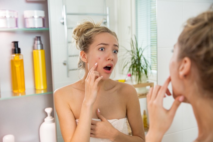 Jerawat puber umur berapa, yuk kenali tanda-tandanya. Foto: Getty Images/iStockphoto/Sasha_Suzi
