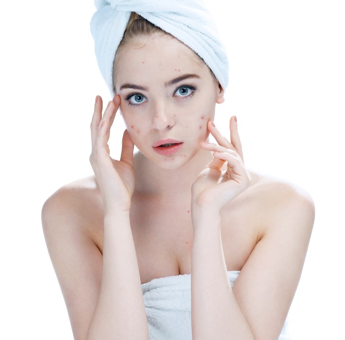 Jenis jerawat dan cara mengatasinya. Foto: Getty Images/iStockphoto/Sasha_Suzi Jenis jerawat dan cara mengatasinya. Foto: Getty Images/iStockphoto/Sasha_Suzi