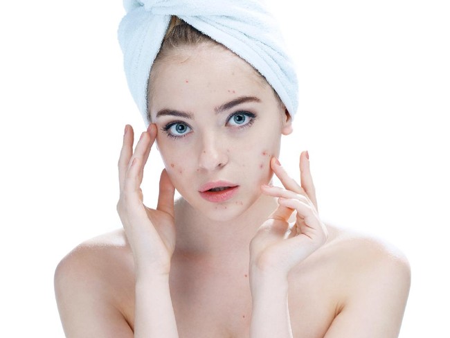 Young beautiful woman surprised to see pimple on skin. Unhappy girl with stunned funny face standing in towel in bathroom, looking in the mirror, pointing to zit