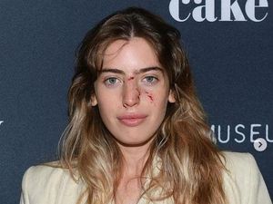 Muka Berdarah Usai Digigit Anjing, Putri Ewan McGregor Eksis di Red Carpet