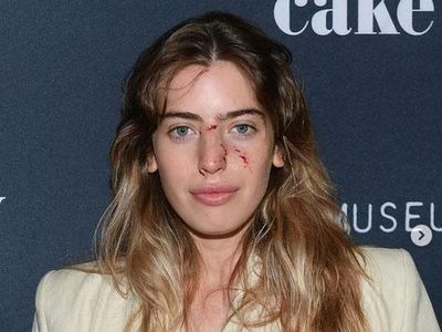 Muka Berdarah Usai Digigit Anjing, Putri Ewan McGregor Eksis di Red Carpet