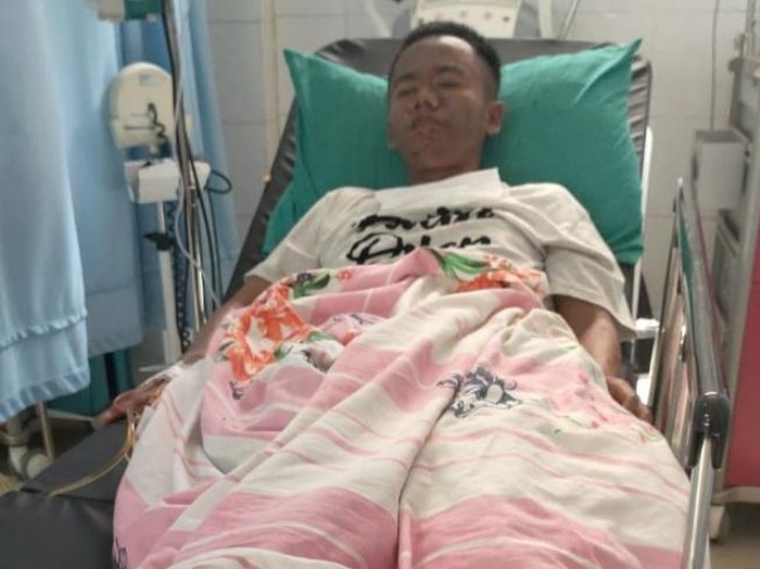 Pemuda difabel di Pandeglang badannya melepuh diduga dicekoki miras