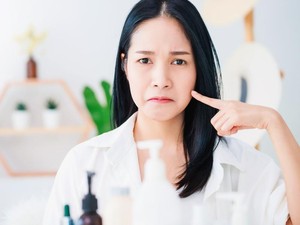 Stres Picu Masalah Kulit? Segera Atasi dengan Cara Ini!
