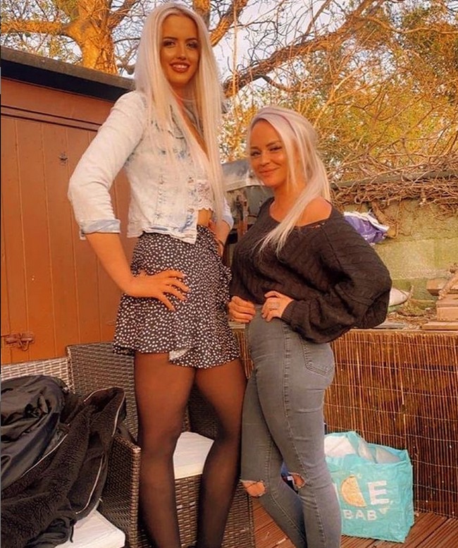 Wanita ini punya tinggi badan di atas rata-rata wanita normal. Tingginya mencapai 190 cm. Punya kaki panjang bak galah membuat wanita bernama Lizzy Groombridge itu jadi korban bully ketika masa sekolah. Foto: Instagram