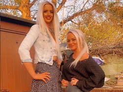 Foto: Penampakan Wanita yang Tingginya 190 Cm, Dulu di-Bully Kini Jadi Sensasi