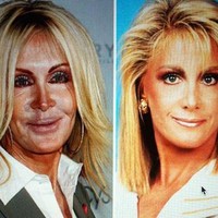 Terakhir ada aktris Amerika bernama Joan Van Ark. Sama seperti selebriti lainnya, Joan melakukan operasi plastik juga untuk membuat penampilannya terlihat lebih cantik. Namun sayang, hasil dari operasi plastik yang dijalaninya ternyata tak sesuai ekspetasi. Joan malah berakhir dengan wajah yang terlihat lebih mengerikan. Foto: Instagram
