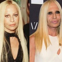 Siapa yang tidak kenal dengan Donatella Francesca Versace? Fashion designer sekaligus pengusaha asal Italia ini telah melakukan beragam prosedur kecantikan yang justru membuat wajahnya jadi telihat lebih buruk. Donatella sendiri mengaku pernah melakukan suntik botox dan sejumlah operasi plastik sejak tahun 1990. Foto: Facebook